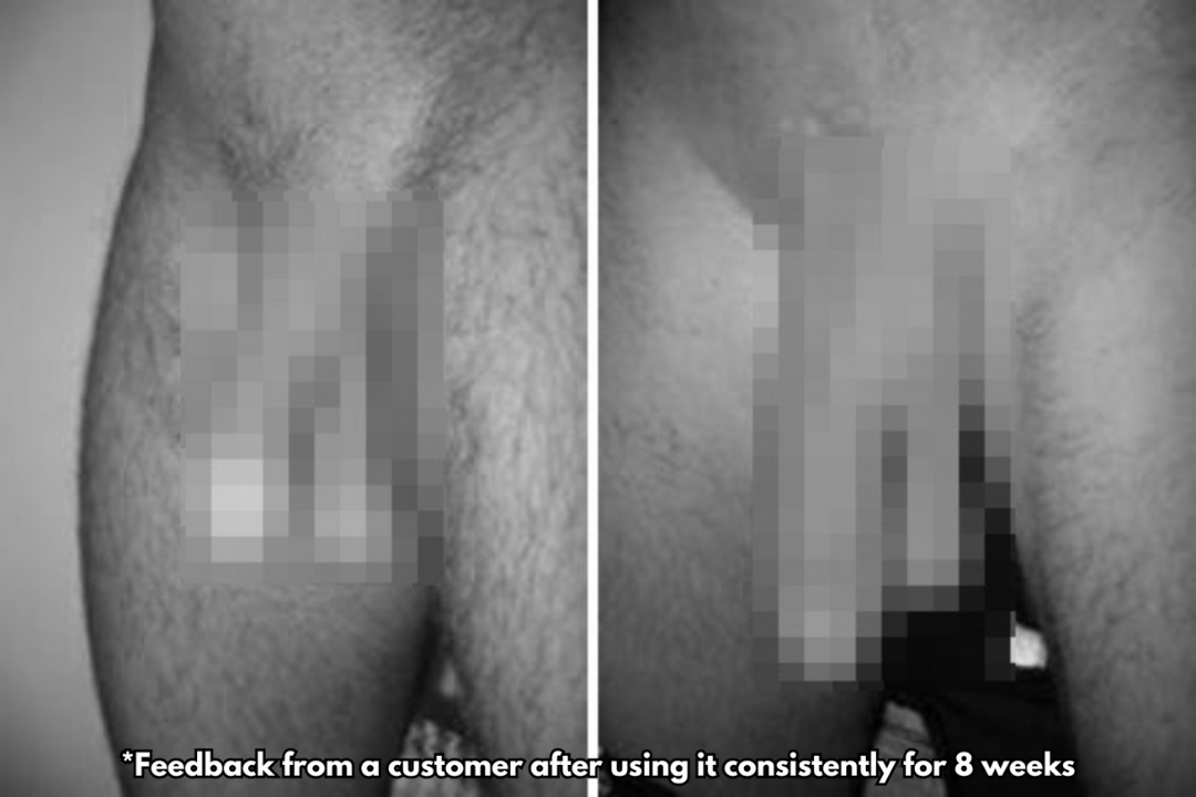 web content MYORO 18